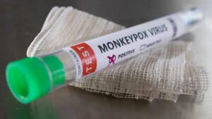 Monkeypox